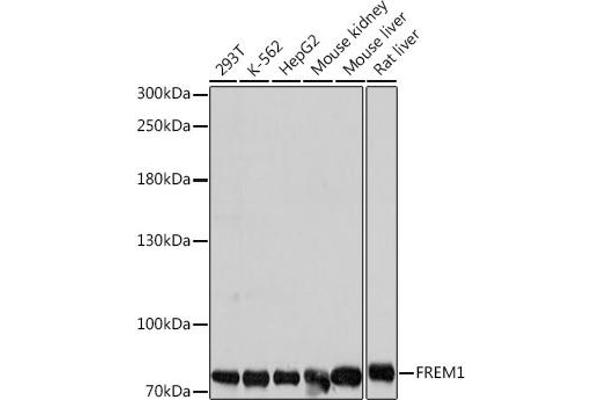 FREM1 Antikörper  (AA 1880-2179)