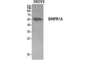 Western Blot (WB) analysis of SKOV3 cells using CD292 Polyclonal Antibody. (BMPR1A Antikörper  (Internal Region))