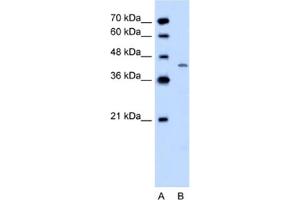 Western Blotting (WB) image for anti-Dihydroorotate Dehydrogenase (DHODH) antibody (ABIN2462506) (DHODH Antikörper)