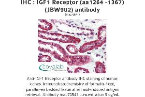 Image no. 2 for anti-Insulin-Like Growth Factor 1 Receptor (IGF1R) (AA 1264-1367) antibody (ABIN1723400) (IGF1R Antikörper  (AA 1264-1367))