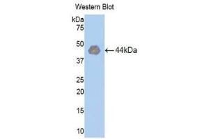 Western Blotting (WB) image for anti-Hexokinase 1 (HK1) (AA 413-540) antibody (ABIN1859172) (Hexokinase 1 Antikörper  (AA 413-540))