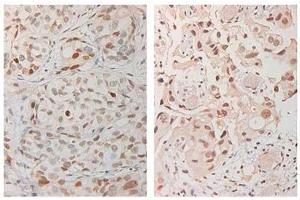 Immunohistochemistry (IHC) image for anti-Ataxia Telangiectasia Mutated (ATM) (AA 1974-1988), (pSer1981) antibody (ABIN6657494)