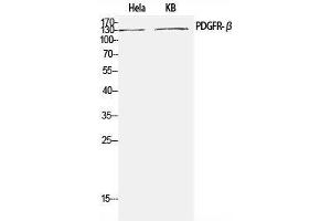 Western Blot analysis of Hela, KB cells using PDGFRB Polyclonal Antibody at dilution of 1:1000. (PDGFRB Antikörper)