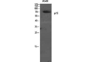 Western Blotting (WB) image for anti-Tumor Protein P73 (TP73) (Tyr220) antibody (ABIN3186304) (Tumor Protein p73 Antikörper  (Tyr220))