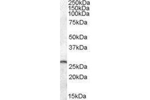 Western Blotting (WB) image for Phosphoserine Phosphatase (PSPH) peptide (ABIN370330) (Phosphoserine Phosphatase (PSPH) Peptid)