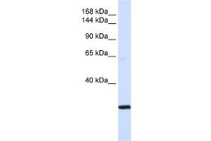 SMC2 antibody used at 1 ug/ml to detect target protein. (SMC2 Antikörper  (N-Term))