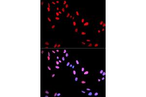 Immunofluorescence analysis of U2OS cells using Phospho-MYC-T58 antibody (ABIN5969925). (c-MYC Antikörper  (pThr58))