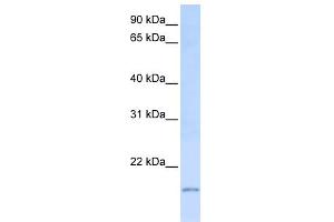 WB Suggested Anti-C20orf30 Antibody Titration:  0. (C20orf30 Antikörper  (C-Term))
