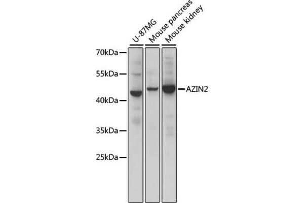 ADC Antikörper  (AA 1-360)