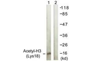 Western Blotting (WB) image for anti-Histone 3 (H3) (H3K18ac) antibody (ABIN2879163) (Histone 3 Antikörper  (H3K18ac))