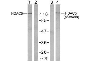 Western blot analysis of extract from NIH/3T3 cells using HDAC5 (Ab-498) antibody (E021142, Lane 1 and 2) and HDAC5 (phospho-Ser498) antibody (E011193, Lane 3 and 4). (HDAC5 Antikörper  (pSer498))
