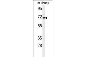 Western blot analysis of FA40B Antibody in mouse kidney tissue lysates (35ug/lane) (STRIP2 Antikörper  (N-Term))
