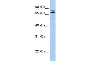WB Suggested Anti-MYST2 Antibody Titration:  0. (MYST2 Antikörper  (N-Term))