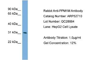 WB Suggested Anti-PPM1M  Antibody Titration: 0. (PPM1M Antikörper  (Middle Region))