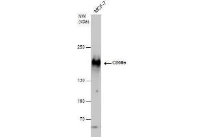 WB Image CD66e antibody detects CD66e protein by western blot analysis. (CEACAM5 Antikörper)