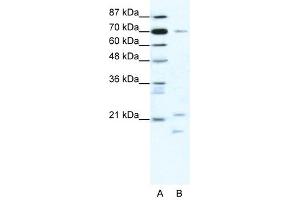 BTF3 antibody (20R-1189) used at 0. (BTF3 Antikörper  (Middle Region))