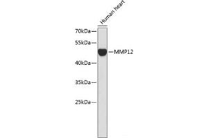 Western blot analysis of extracts of Human heart using MMP12 Polyclonal Antibody. (MMP12 Antikörper)