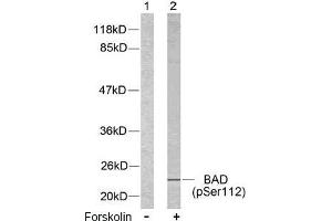 Image no. 2 for anti-BCL2-Associated Agonist of Cell Death (BAD) (pSer112), (pSer75) antibody (ABIN196735) (BAD Antikörper  (pSer75, pSer112))