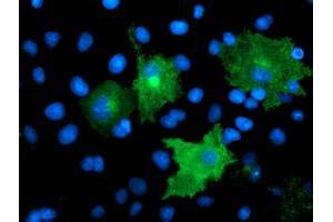 Immunofluorescence (IF) image for anti-Transmembrane Protein with EGF-Like and Two Follistatin-Like Domains 2 (TMEFF2) antibody (ABIN1501415) (TMEFF2 Antikörper)