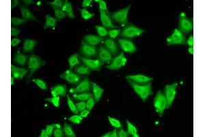 Immunofluorescence analysis of HeLa cells using ATXN3 antibody (ABIN5970585). (Ataxin 3 Antikörper)