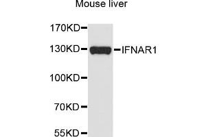 Western blot analysis of extracts of mouse liver, using IFNAR1 antibody (ABIN5970858) at 1/1000 dilution. (IFNAR1 Antikörper)