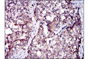 Immunohistochemistry (IHC) image for anti-Serpin Family A Member 7 (SERPINA7) (AA 168-302) antibody (ABIN1724894)