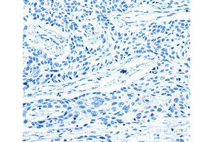 Immunohistochemistry (IHC) image for anti-G Protein-Coupled Receptor Kinase 1 (GRK1) antibody (ABIN1872898) (GRK1 Antikörper)