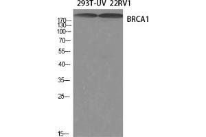 Western Blotting (WB) image for anti-Breast Cancer 1 (BRCA1) (Ser1423) antibody (ABIN5959016) (BRCA1 Antikörper  (Ser1423))
