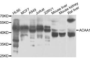 Western blot analysis of extracts of various cell lines, using ACAA1 antibody (ABIN5975522) at 1/1000 dilution. (ACAA1 Antikörper)