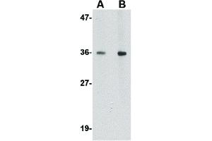 Western Blot of BRAL1 Antibody Western Blot of BRAL1 antibody. (HAPLN2 Antikörper  (Internal Region))