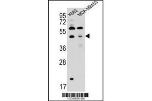 Western blot analysis in K562,MDA-MB453 cell line lysates (35ug/lane). (SNX29 Antikörper  (C-Term))