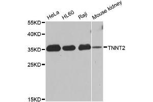 Western blot analysis of extracts of various cell lines, using TNNT2 antibody (ABIN1875151) at 1:1000 dilution. (Cardiac Troponin T2 Antikörper)