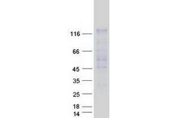 USP20 Protein (Transcript Variant 1) (Myc-DYKDDDDK Tag)