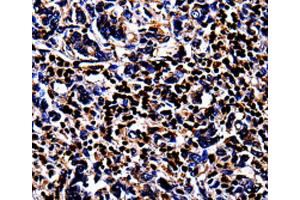 Immunohistochemistry (IHC) image for anti-S100 Calcium Binding Protein A4 (S100A4) antibody (ABIN2420929) (s100a4 Antikörper)