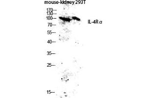 Western blot analysis of Mouse-kidney, 293T lysate using IL-4Rα antibody. (IL4 Receptor Antikörper)