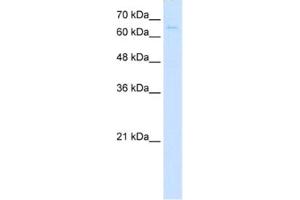 Western Blotting (WB) image for anti-CTP Synthase (CTPS) antibody (ABIN2462931) (CTP Synthase Antikörper)