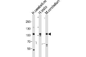 Western blot analysis of lysates from human cerebellum, human testis, mouse cerebellum tissue lysate (from left to right), using SKOR2 Antibody (C-term) (ABIN6244147 and ABIN6577773). (SKOR2 Antikörper  (C-Term))