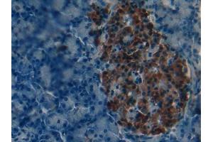 IHC-P analysis of Mouse Pancreas Tissue, with DAB staining. (PNPLA2 Antikörper  (AA 481-702))