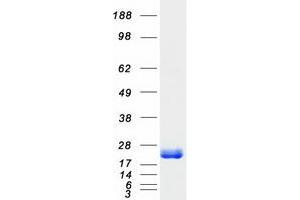 Validation with Western Blot (ARF3 Protein (Myc-DYKDDDDK Tag))