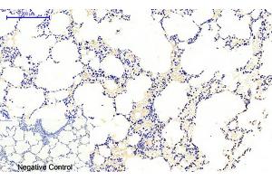 Immunohistochemical analysis of paraffin-embedded rat lung tissue. (JAK1 Antikörper  (pTyr1022))