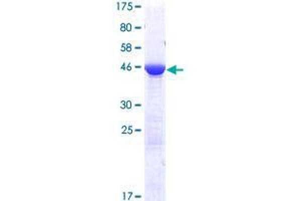 EMC9 Protein (AA 1-208) (GST tag)