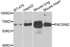 Western blot analysis of extracts of various cell lines, using PACSIN2 antibody. (PACSIN2 Antikörper)