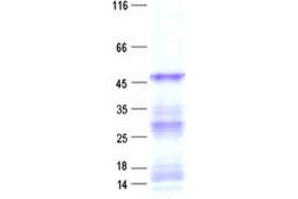 CPA6 Protein (His tag)