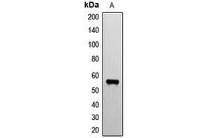 Western blot analysis of ETV1 expression in mouse brain (A) whole cell lysates. (ETV1 Antikörper  (N-Term))