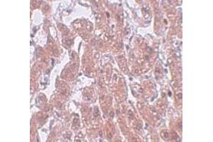 Immunohistochemistry (IHC) image for anti-Family with Sequence Similarity 59, Member A (FAM59A) (C-Term) antibody (ABIN1030387) (FAM59A Antikörper  (C-Term))