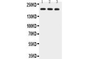 Anti-BRCA1 Picoband antibody,  All lanes: Anti-BRCA1 at 0. (BRCA1 Antikörper  (AA 1661-1863))