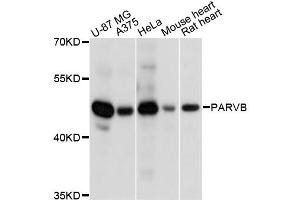 Western blot analysis of extracts of various cell lines, using PARVB antibody (ABIN6290187) at 1:3000 dilution. (Parvin, beta Antikörper)