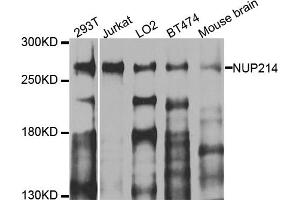 Western blot analysis of extracts of various cell lines, using NUP214 antibody (ABIN5974670) at 1/1000 dilution. (NUP214 Antikörper)