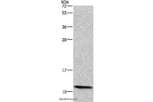 Western blot analysis of HepG2 cell, using HSPE1 Polyclonal Antibody at dilution of 1:750 (HSPE1 Antikörper)