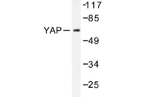 Image no. 1 for anti-Yes-Associated Protein 1 (YAP1) antibody (ABIN272105) (YAP1 Antikörper)
